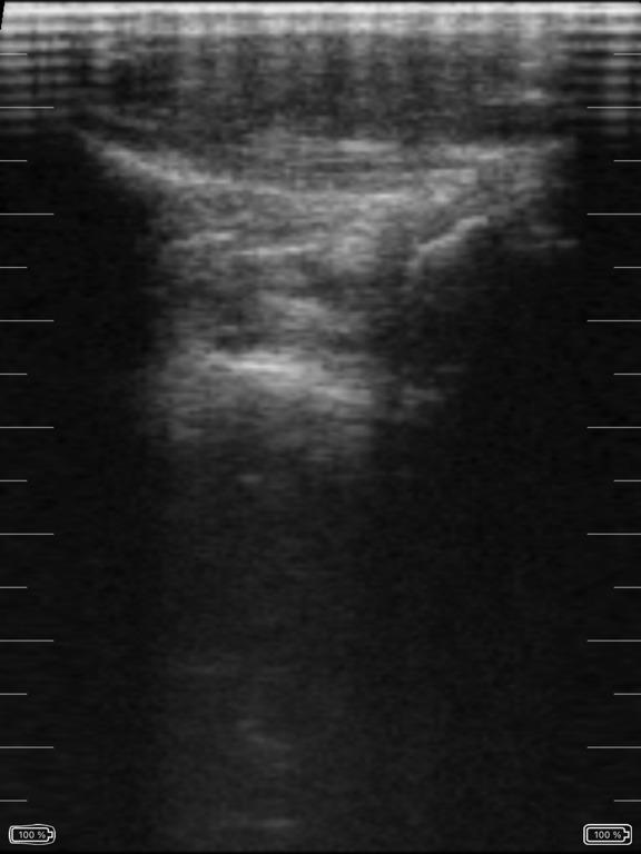 Screenshot #4 pour Tecnoscan Connect