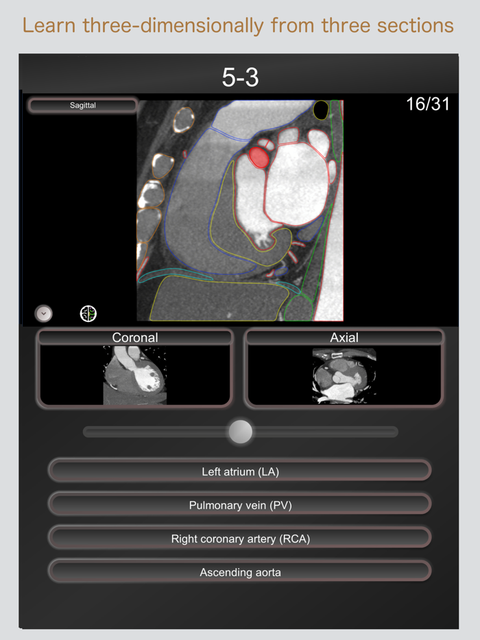 CT PassQuiz Heart - MRI