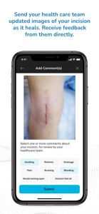 VELYS Patient Path - Patients screenshot #5 for iPhone