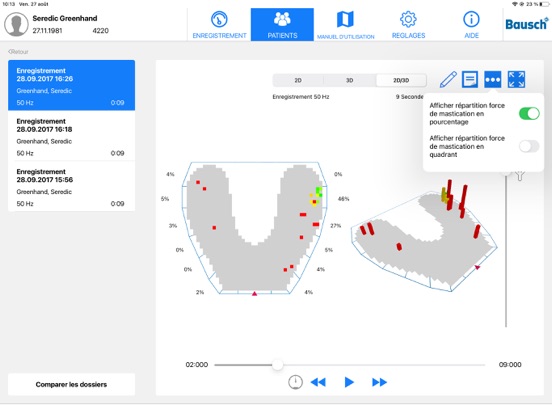 Screenshot #6 pour OccluSense
