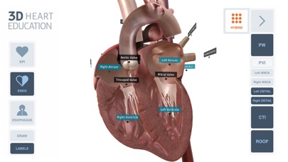 3D Heart Education Screenshot
