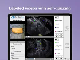 Game screenshot obNAV: Ultrasound Education apk