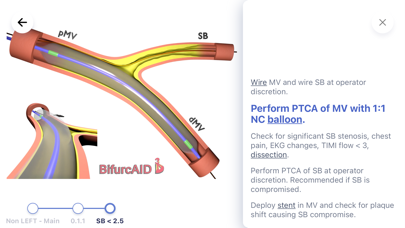 BifurcAID 3D Screenshot