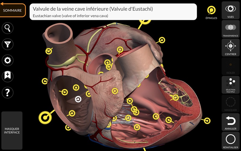 Screenshot #2 pour Anatomie - Atlas 3D