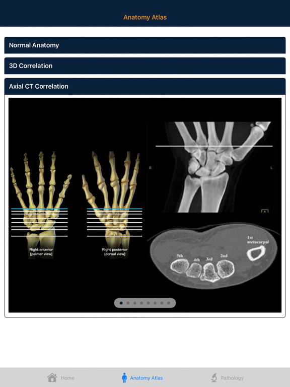 CTisus: CT of the Hand & Wrist iPad screenshot 7 - Medical app