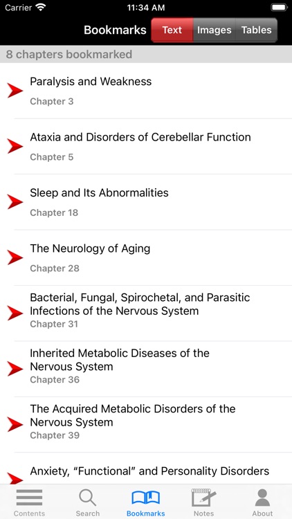 Adams & Victor's Neurology 12E screenshot-9