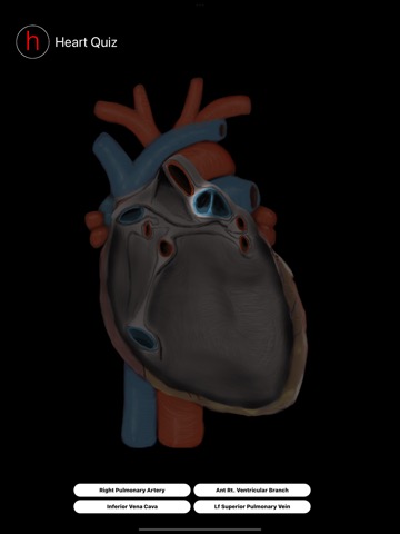 Human Heart Anatomy Quizのおすすめ画像6