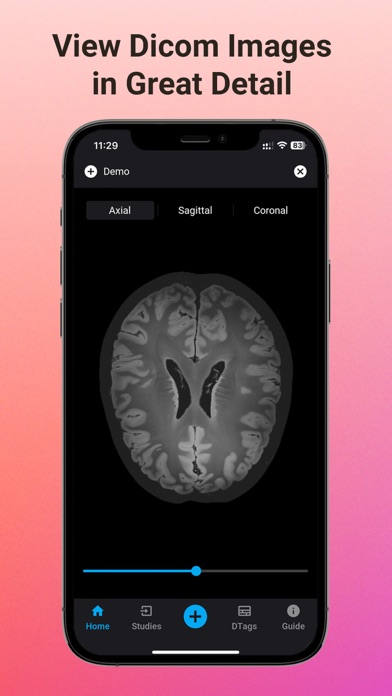 DICOM Vision Mobile Screenshot