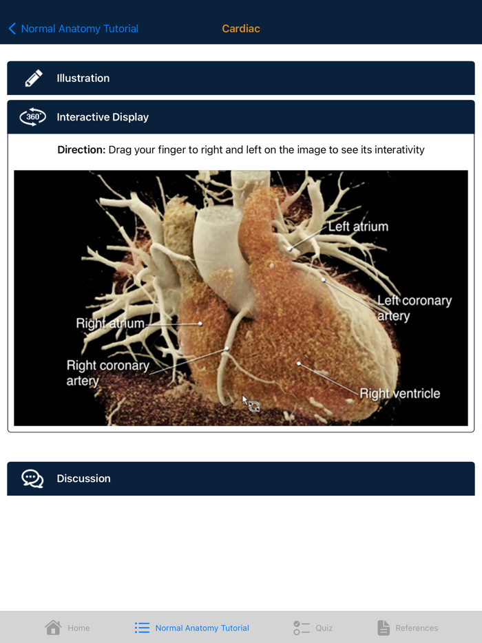 CTisus Chest Atlas 3D CRT