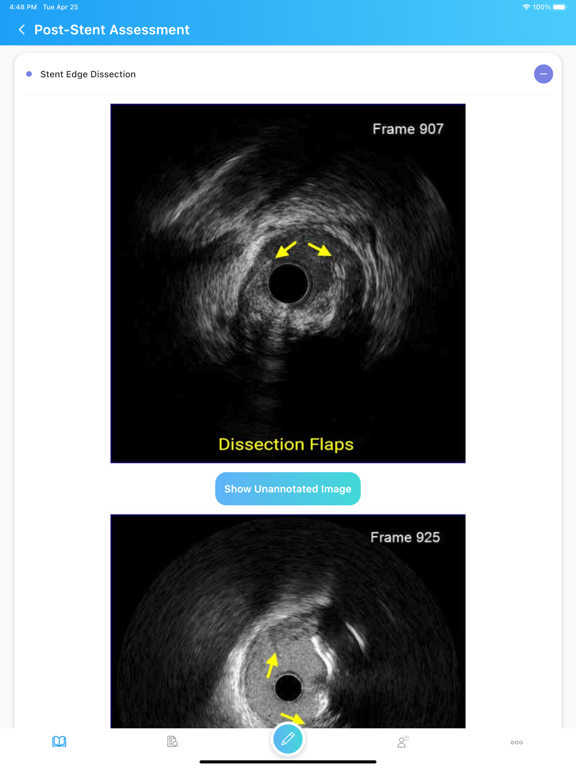 IVUSAID iPad screenshot 5 - Medical app