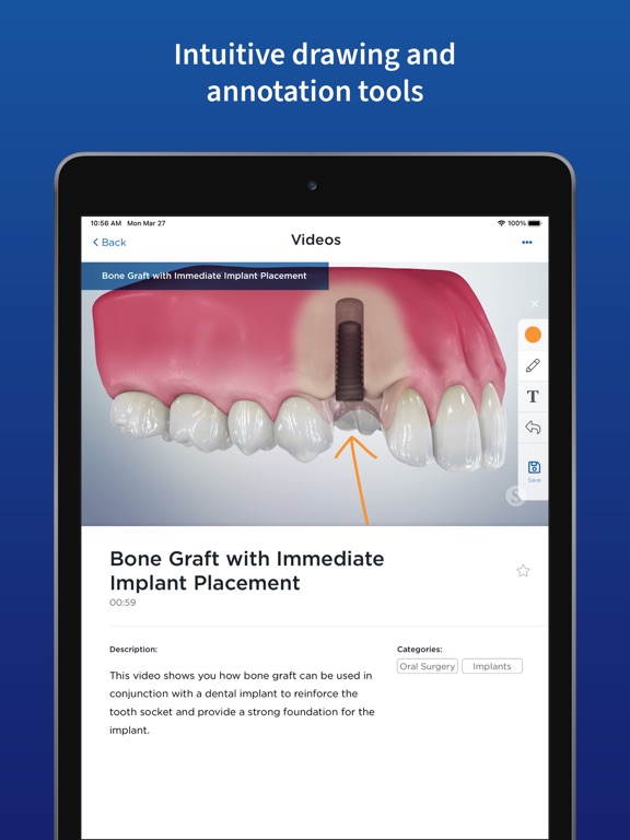 Screenshot #5 pour Spear Patient Education