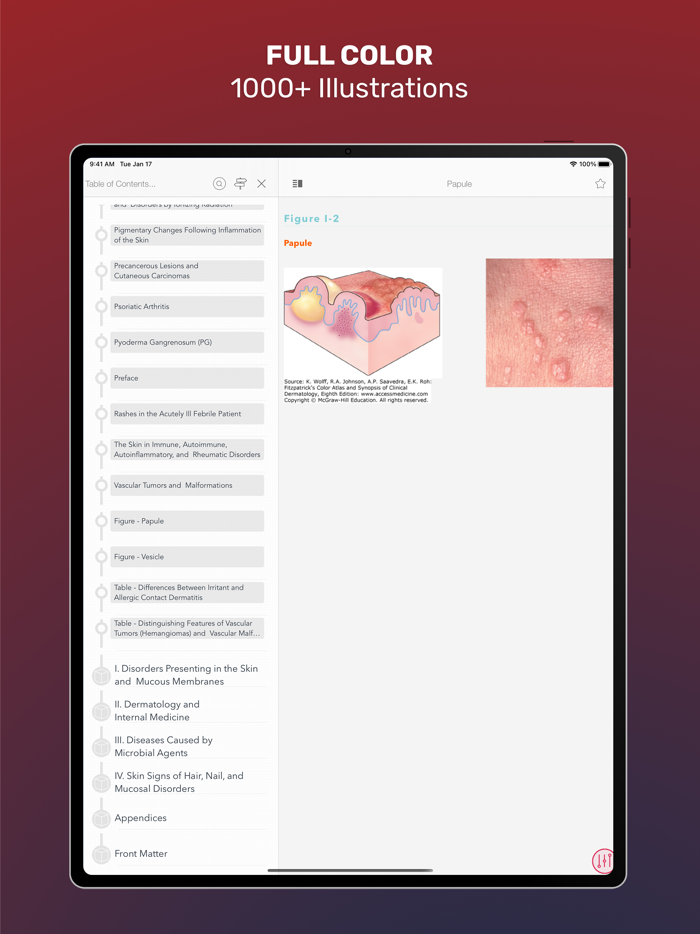 Fitzpatricks Color Atlas