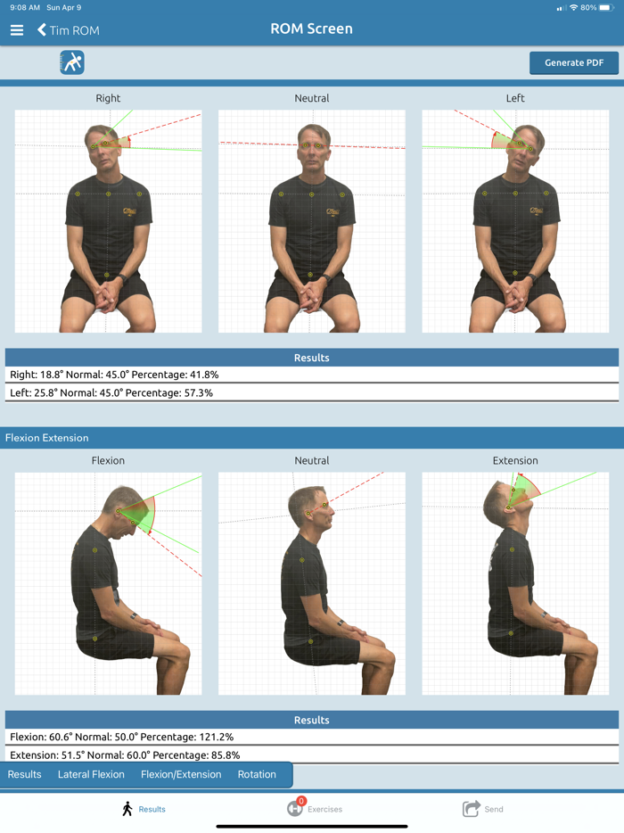 PostureScreen Mobile