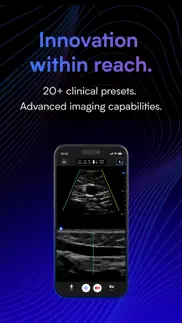 butterfly iq — ultrasound iphone screenshot 2