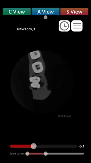 Zumax Dicom Viewer - CN screenshot 3