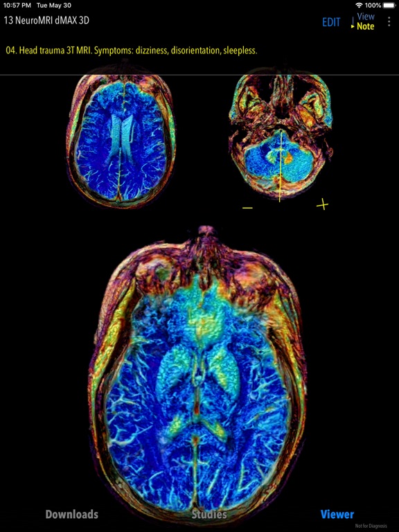 Screenshot #5 pour MedVizi™ CT-MRI Viewer