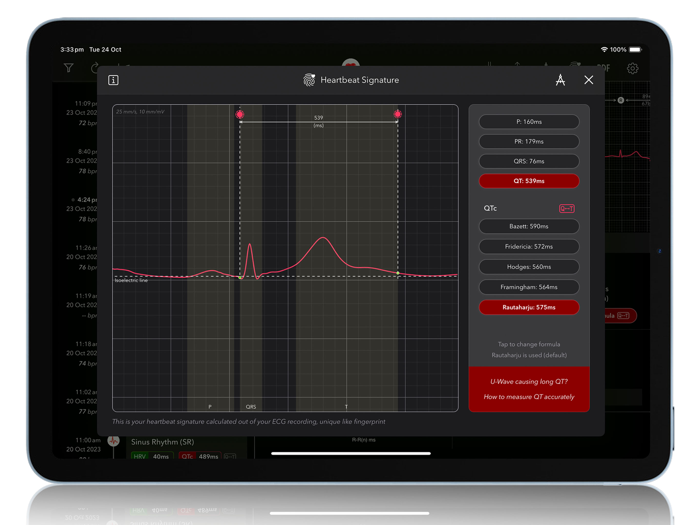 ECG  Analyzer for QTc and HRV