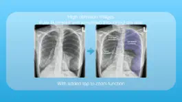 Game screenshot Chest X-rays hack