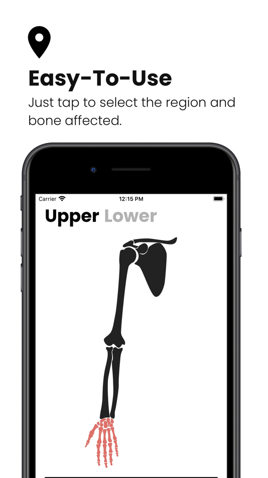 #1. Fractures: Splinting App (iOS) Podle: Tom Fadial