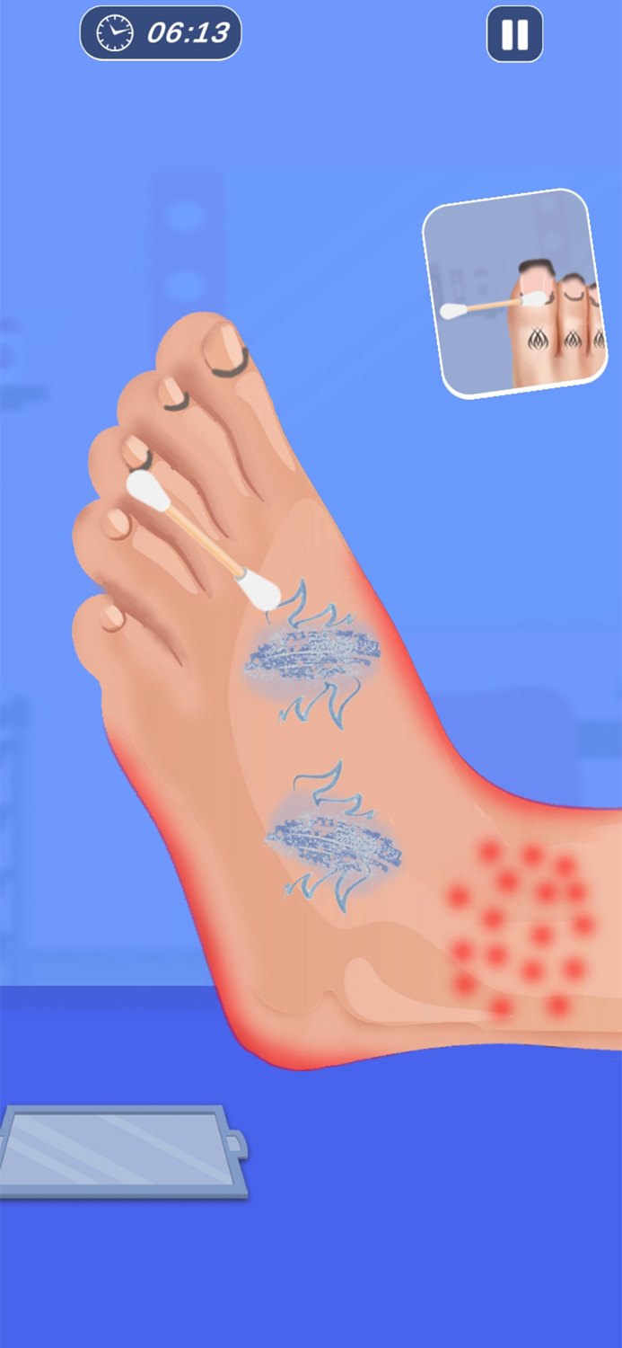 ASMR Foot Care Doctor Games