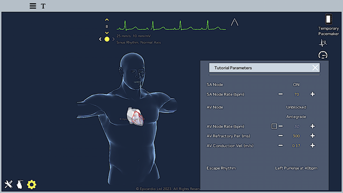 Temporary Cardiac Pacing