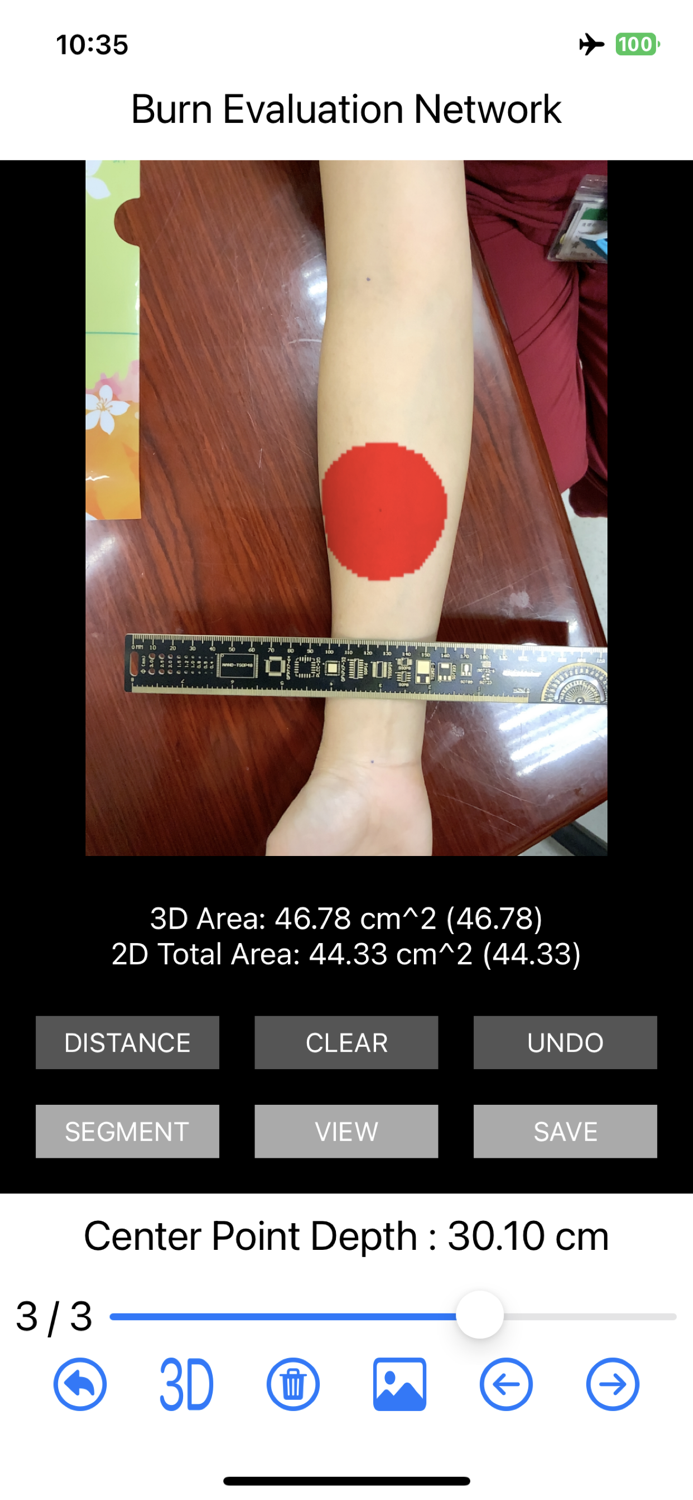 Burn Evaluation Network