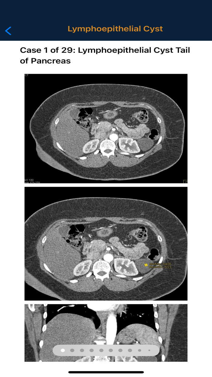 CTisus Pancreas Compendium
