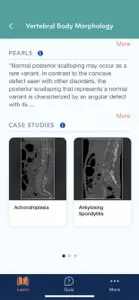 CTisus L-Spine Pathology screenshot #6 for iPhone