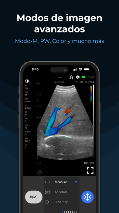 SonoExpert - MediExpert Screenshot