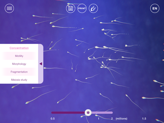 Screenshot #6 pour U-Theramex