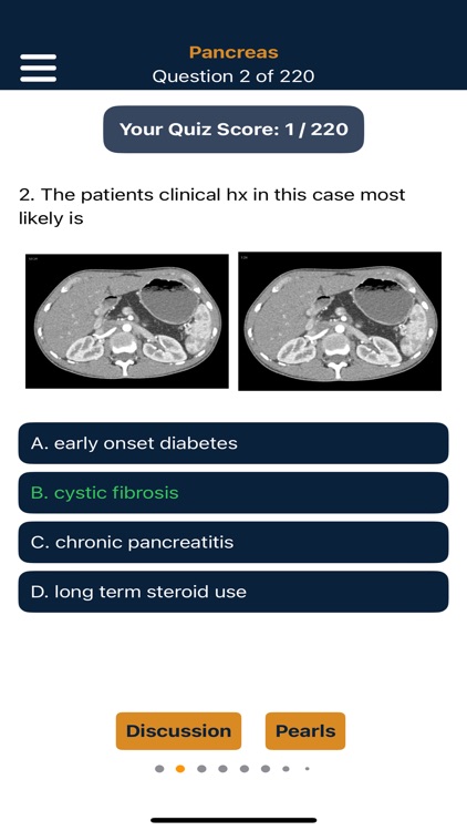 CTisus Pancreas Compendium screenshot-9