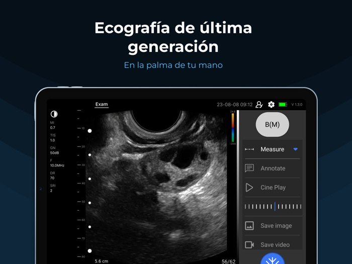 SonoExpert - MediExpert