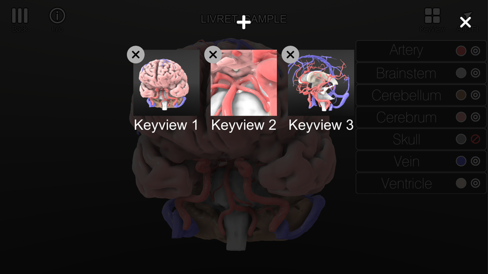 #4. LIVRET : 3D Model Viewer (iOS) 由: 株式会社Kompath