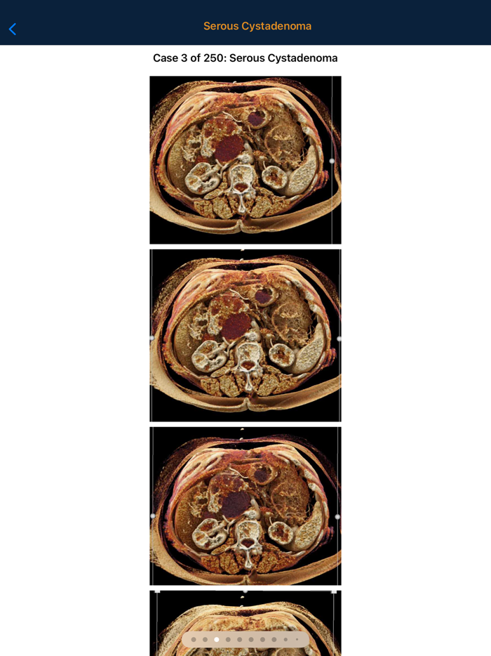 CTisus Pancreas Compendium