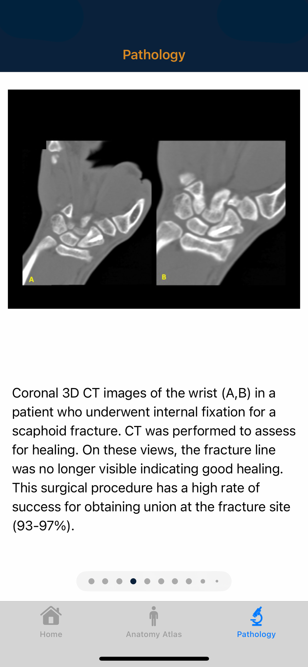CTisus: CT of the Hand & Wrist
