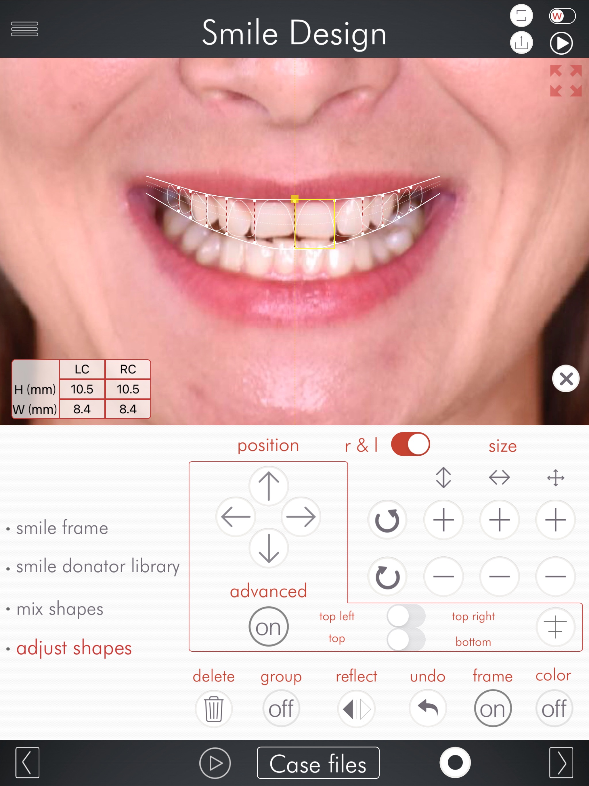 DSD Appのおすすめ画像10