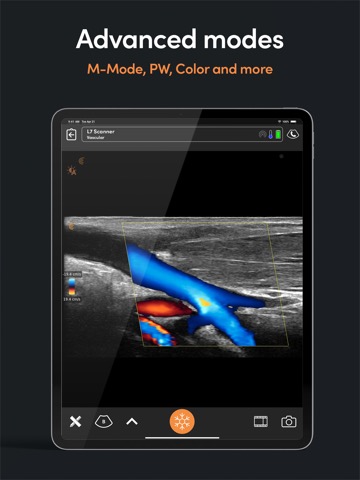 Clarius Ultrasound Appのおすすめ画像4