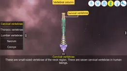 How to cancel & delete our bony scaffold 1