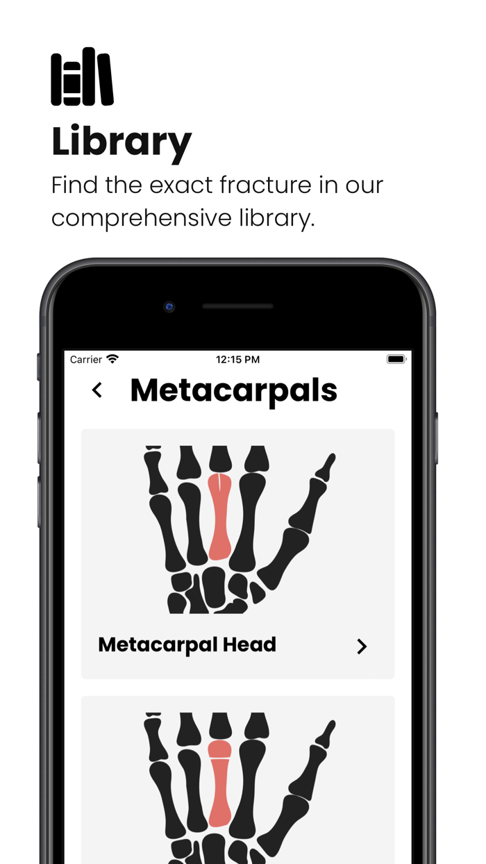 Fractures Splinting App