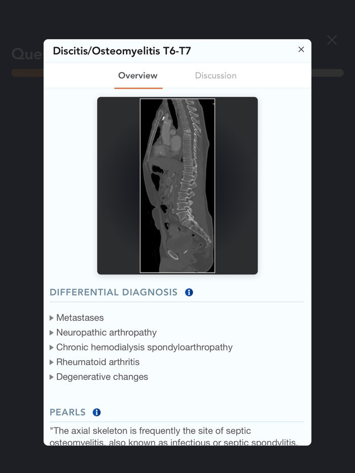 CTisus L-Spine Pathology