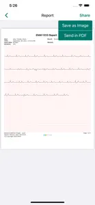 EMAY Portable ECG Monitor screenshot #4 for iPhone