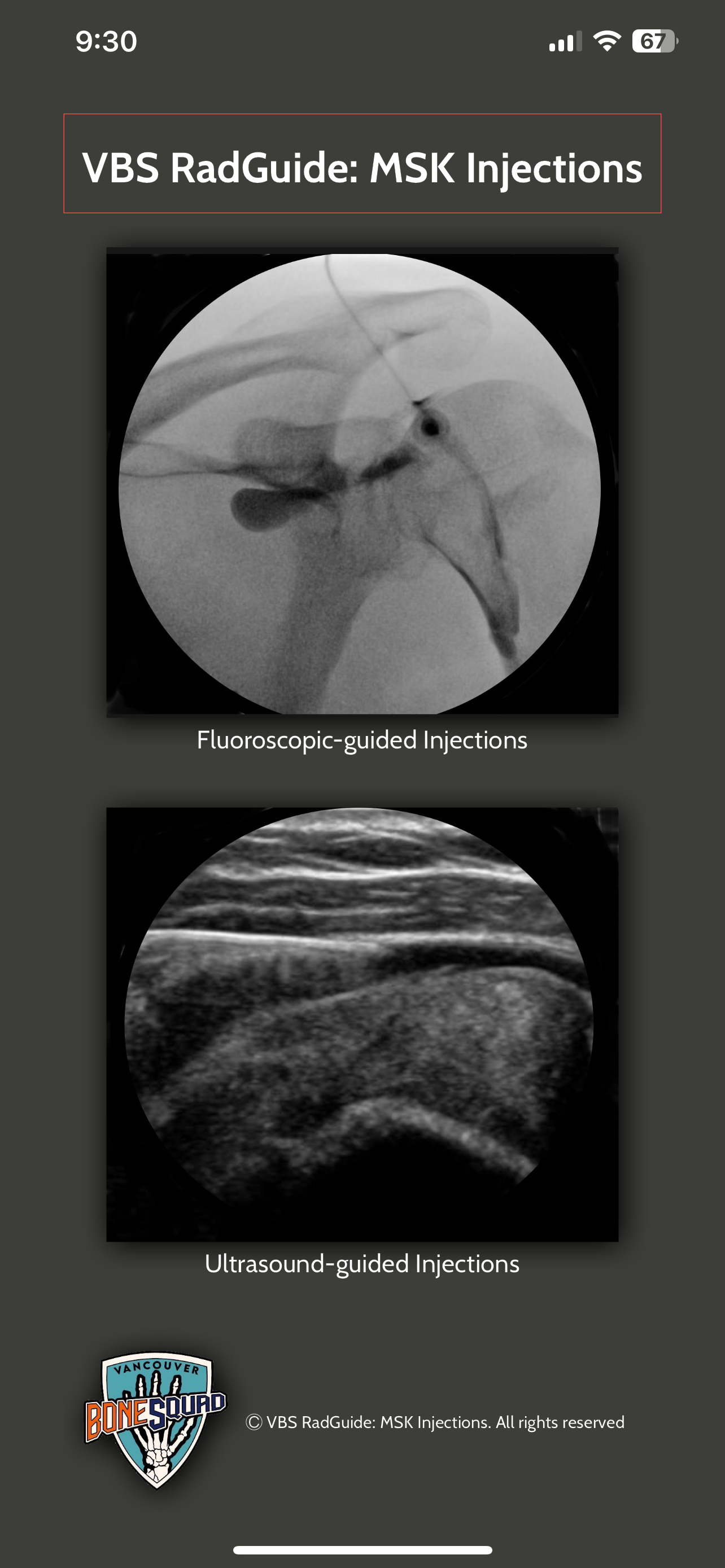 VBS RadGuide: MSK Injections