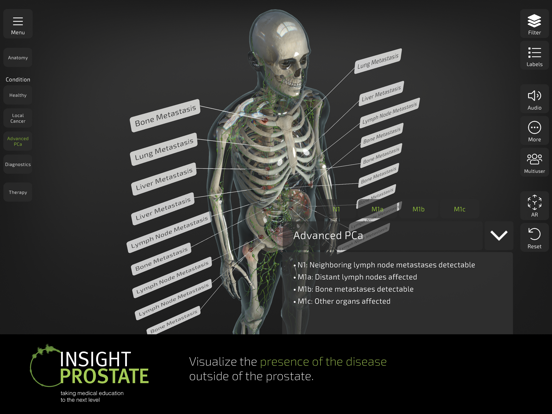 INSIGHT PROSTATE Screenshots