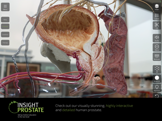 INSIGHT PROSTATE Screenshots