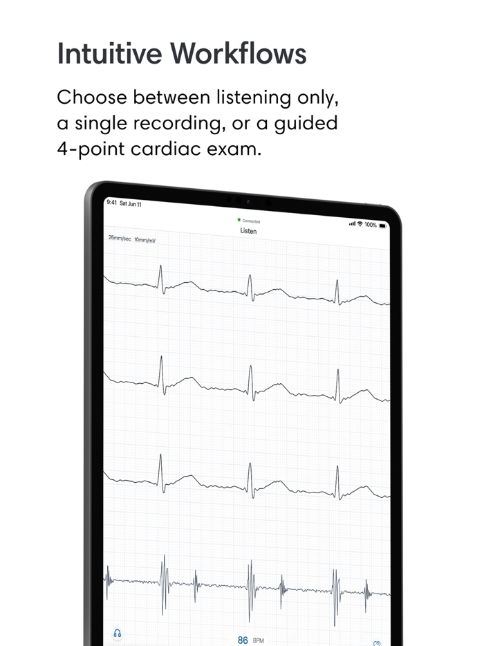Eko Digital Stethoscope  ECG