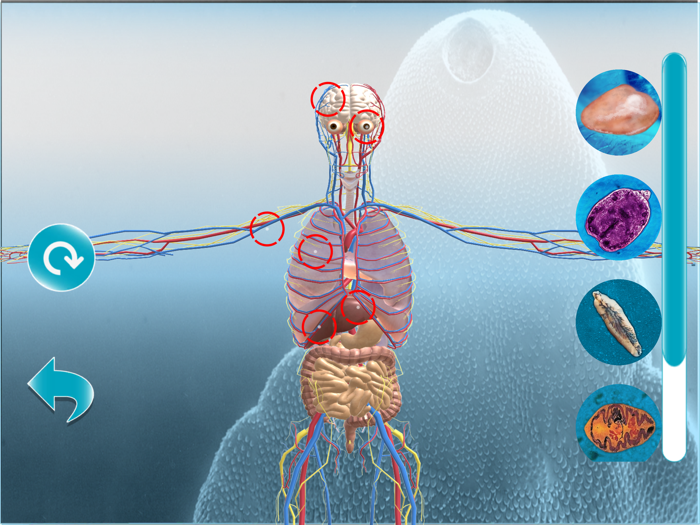 Parásitos sistémicos