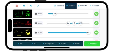 TruMonitor - TruVent - Medical App | MWM
