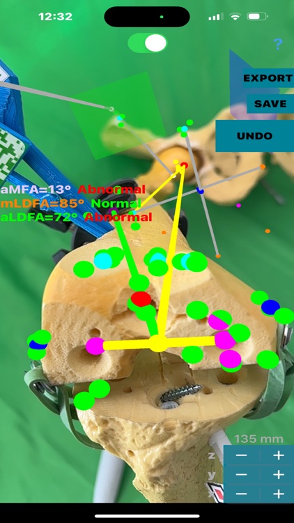 KneeNaviAR screenshot-8