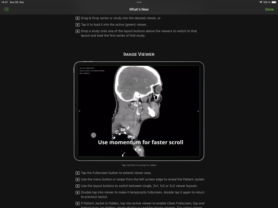 Visage Ease iPad screenshot 7 - Medical app