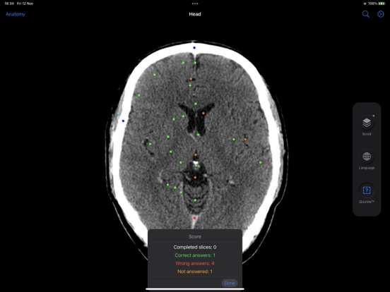 CT Anatomyのおすすめ画像5